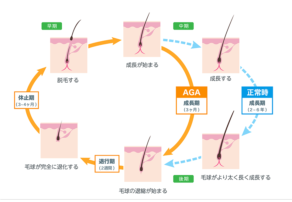 AGAヘアサイクル