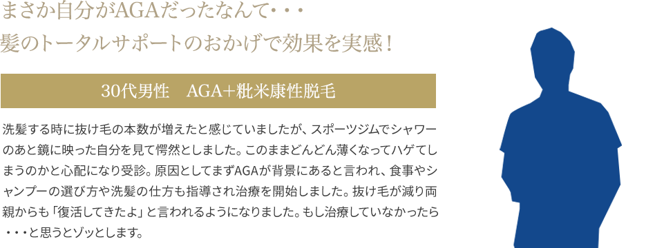 30代男性　AGA発毛効果を実感